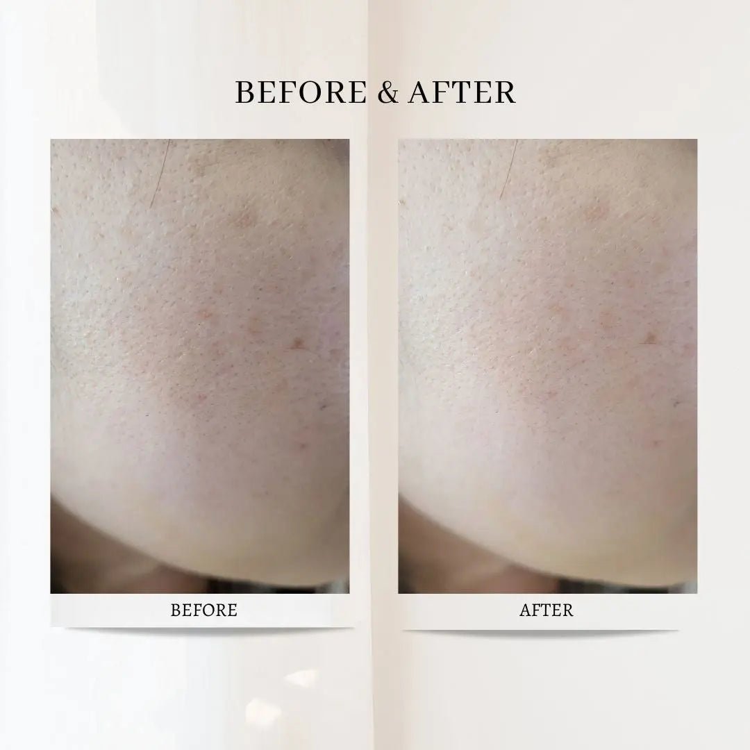 (3 Units) Triple Hyaluronic Acid Serum Bundle